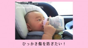 赤ちゃんの顔にひっかき傷が！肌トラブルを防ぐためのケアと対策