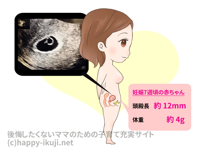 妊娠初期は胸がちくちくする!妊娠２か月は体調が激変します