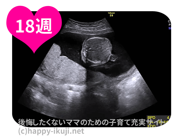 妊娠18週(18w)のエコーで性別判明！50人の赤ちゃんの位置と胎動はどんな感じ?