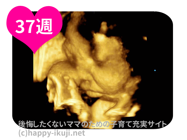 妊娠37週(37w)の内診とお腹の張り!50人の妊婦が感じた産まれる前兆